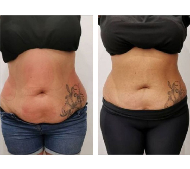 Typhoon 2.0 - Aplicatoare