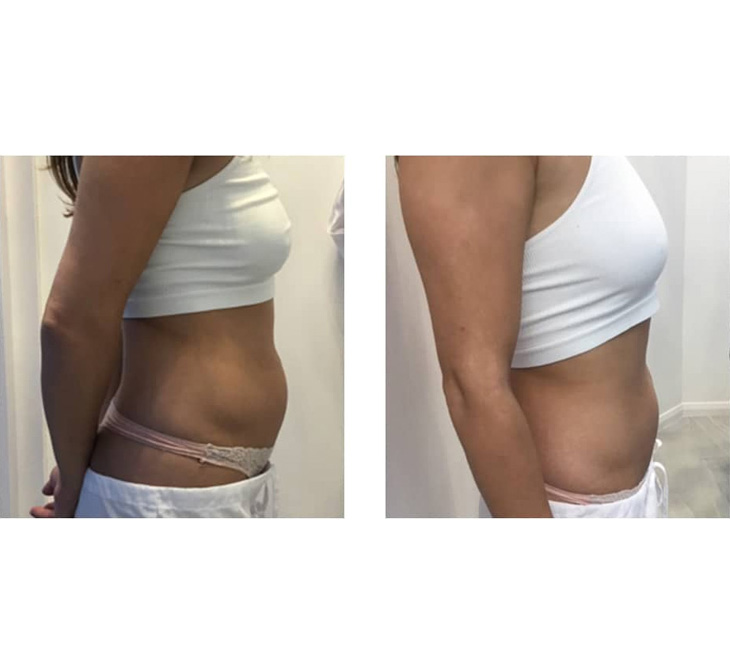 Typhoon 2.0 - Aplicatoare