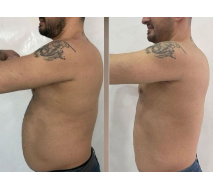 Typhoon 2.0 - Aplicatoare